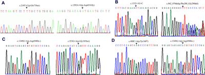 Four novel variants identified in the ACADVL gene causing very-long-chain acyl-coenzyme A dehydrogenase deficiency in four unrelated Chinese families